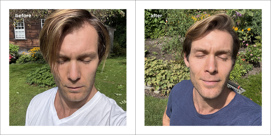 Strengthening Daily Care System - 2