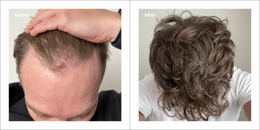 Strengthening Daily Care System - 3