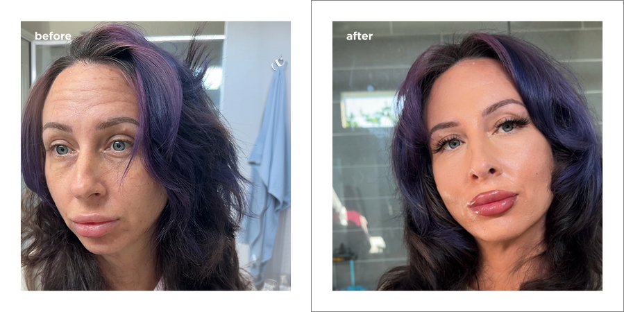 Strengthening Daily Care System - 11